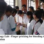 Hematology lab finger pricking for Bleeding time