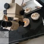 Temporal bone dissection in temporal bone lab
